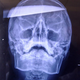 Image for article titled Kotaku 'Shop Contest: X-Ray Edition
